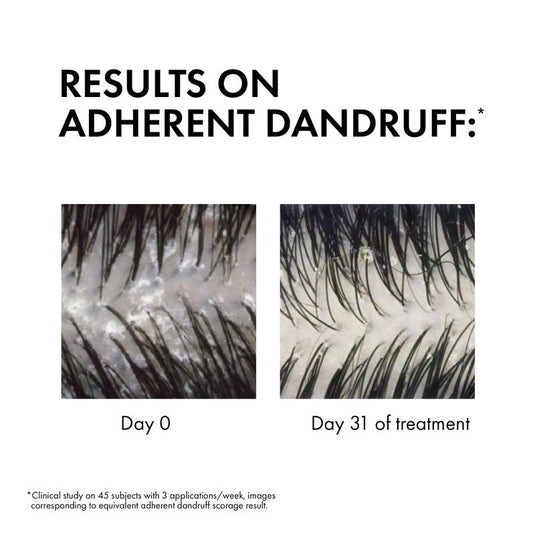 Dercos Anti-Dandruff Ds Shampoo Dry Hair 390ml