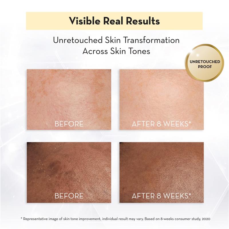 Load image into Gallery viewer, Olay Luminous Niacinamide Honey Peptide Super Serum 30ml
