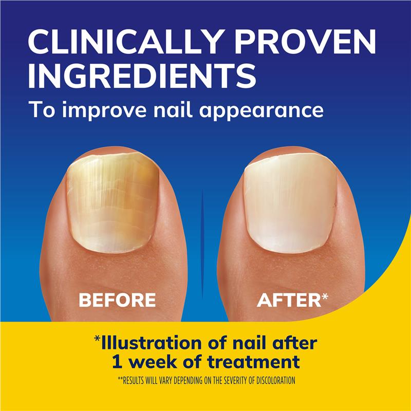 Load image into Gallery viewer, Scholl Nail Revitaliser Serum 43.2g
