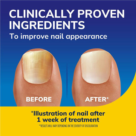 Scholl Nail Revitaliser Serum 43.2g