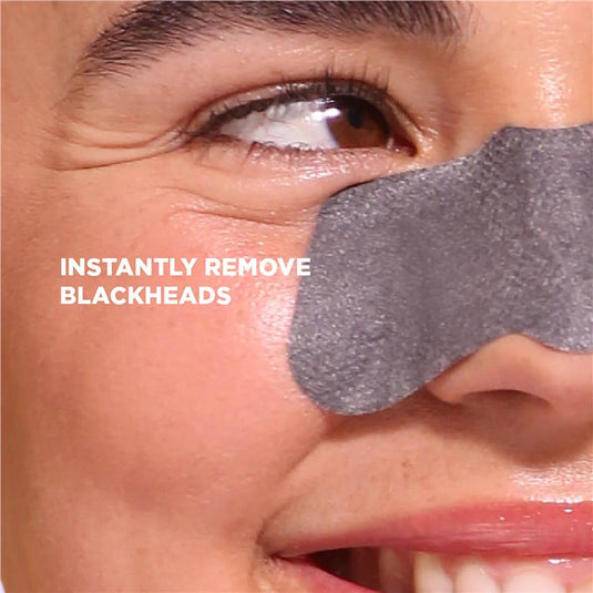 Skin Republic Charcoal Nose Strips