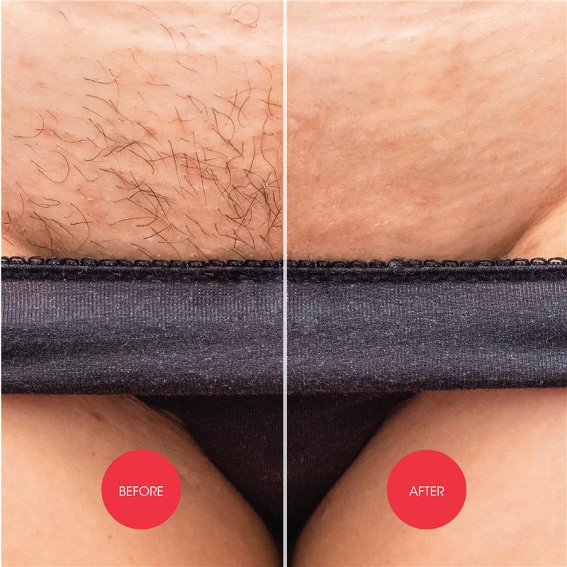 Load image into Gallery viewer, Nads Down Under Hair Removal Cream 150ml

