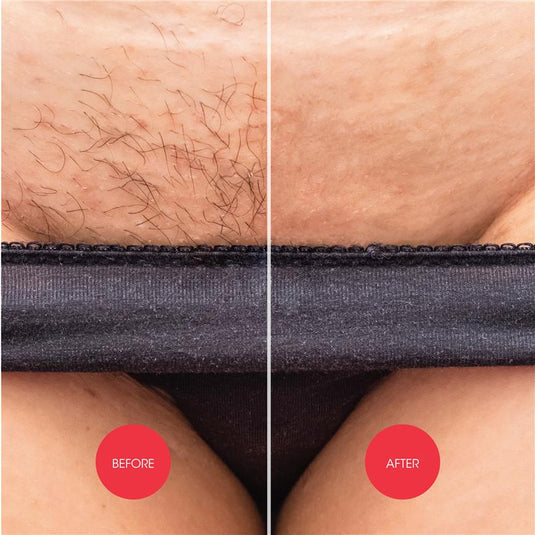 Nads Down Under Hair Removal Cream 150ml