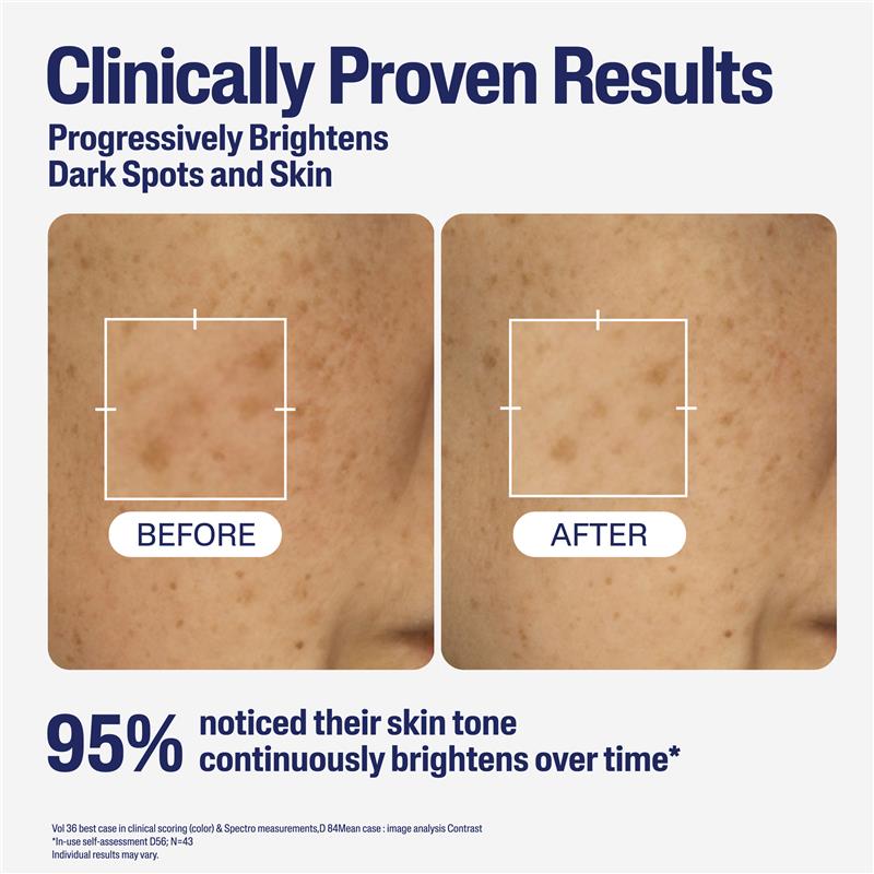 Load image into Gallery viewer, Cetaphil Bright Healthy Radiance Perfecting Serum 30ml
