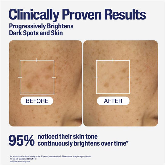 Cetaphil Bright Healthy Radiance Perfecting Serum 30ml