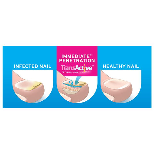 Excilor Fungal Nail Solution 3.3ml