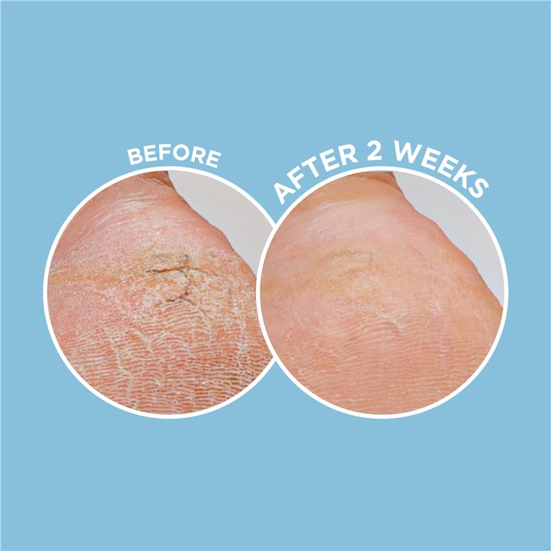 Load image into Gallery viewer, Dermal Therapy Heel Magic 70g

