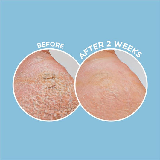 Dermal Therapy Heel Magic 70g