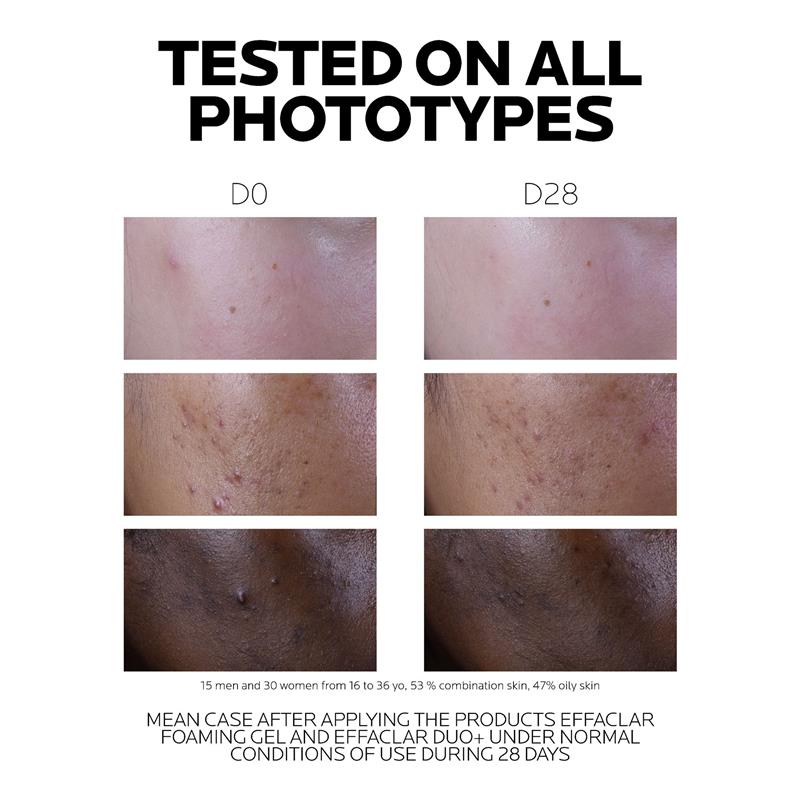 Load image into Gallery viewer, La Roche Posay Effaclar Duo + M 40ml
