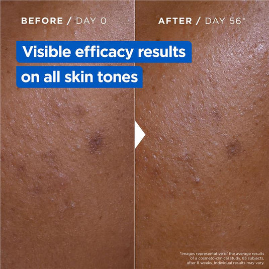 Mixa Niacinamide Bright Moisturising Anti-Dark Spot Cream 400ml