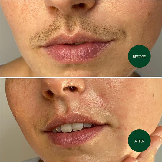 Nad's Facial Wax Strips 20