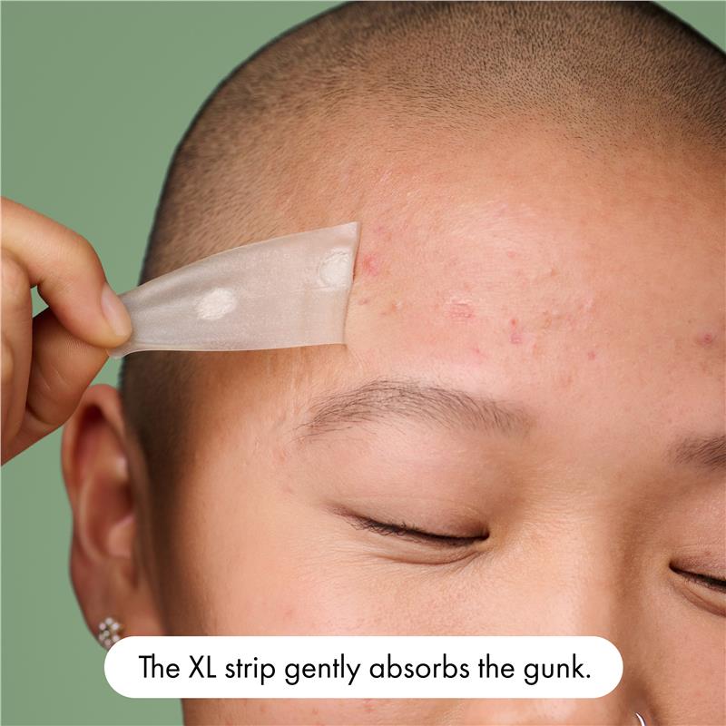 Load image into Gallery viewer, Hero Mighty Patch Surface Pimple Patches 10 pack

