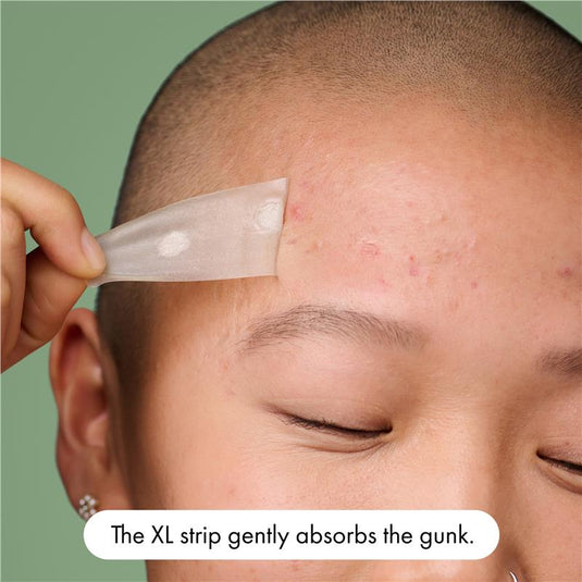 Hero Mighty Patch Surface Pimple Patches 10 pack