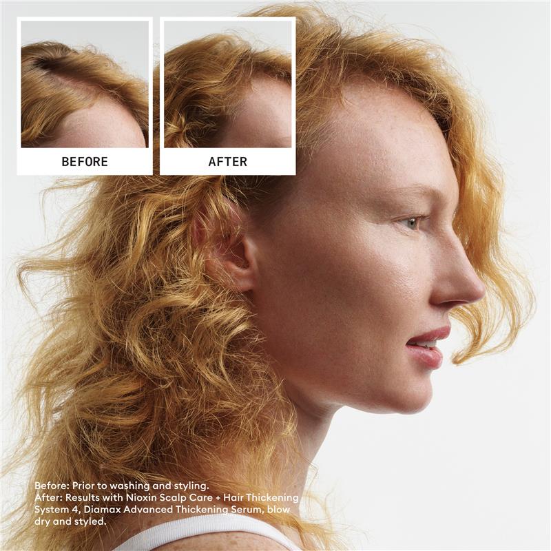 Load image into Gallery viewer, Nioxin Scalp + Hair Thickening System 4 Trial Kit
