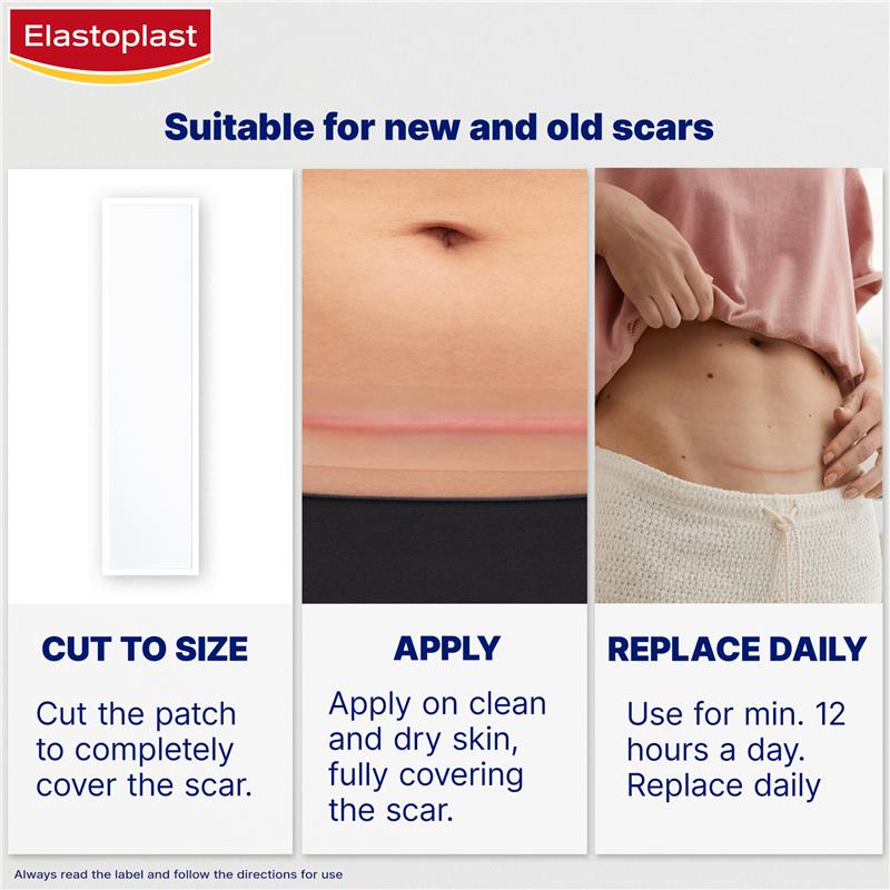 Load image into Gallery viewer, Elastoplast Scar Reducer XL 21 Patches
