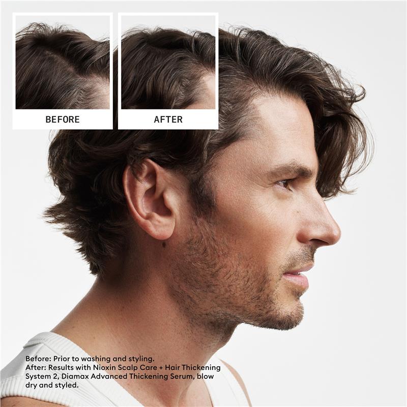 Load image into Gallery viewer, Nioxin Scalp + Hair Thickening System 2 Trial Kit
