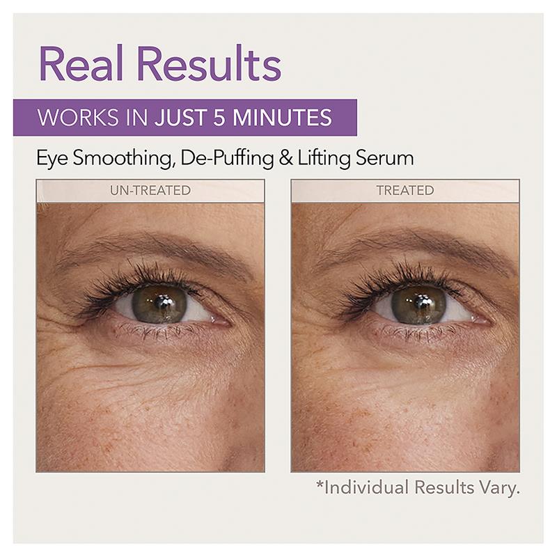 Load image into Gallery viewer, Skin Doctors Instant Eyelift 10ml
