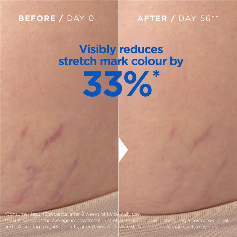 Load image into Gallery viewer, Mixa Stretch Mark Oil 100ml
