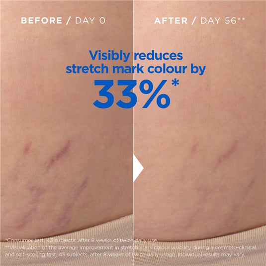 Mixa Stretch Mark Oil 100ml