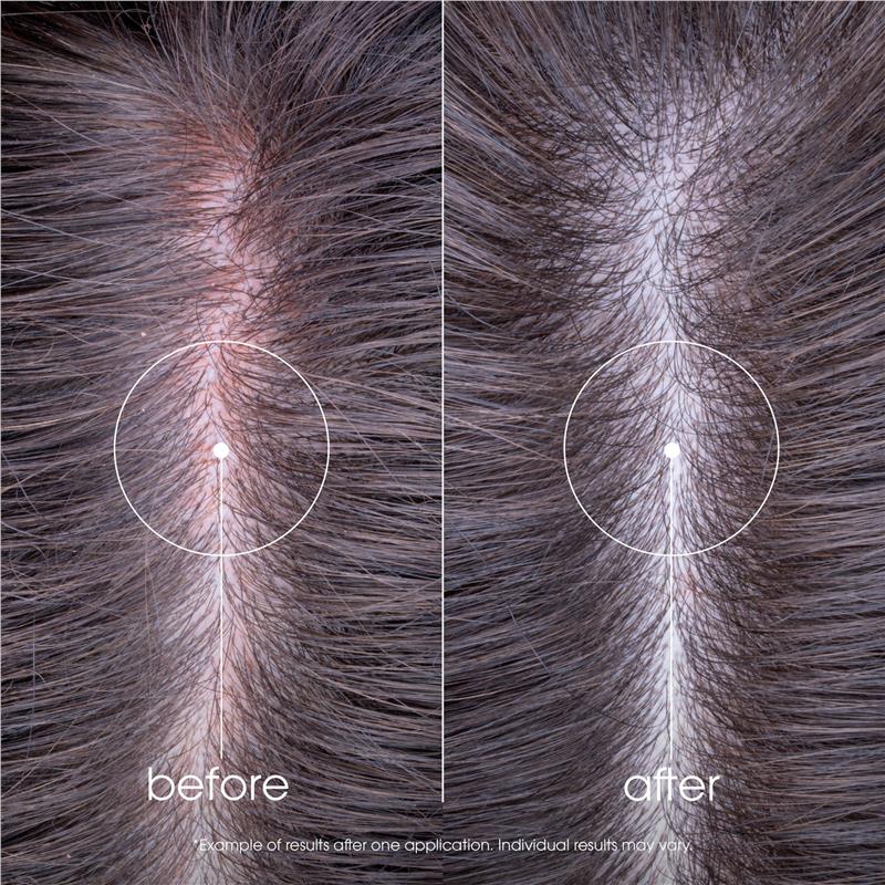 Load image into Gallery viewer, Klorane Soothing Shampoo with Peony 400ml - Sensitive Scalp

