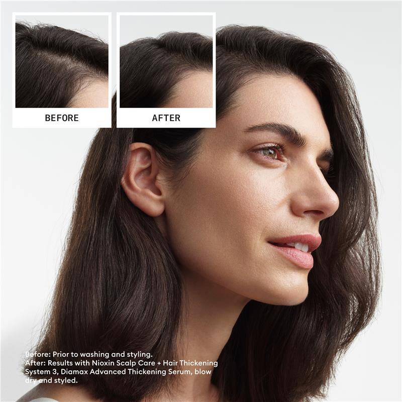 Load image into Gallery viewer, Nioxin Scalp + Hair Thickening System 3 Trial Kit
