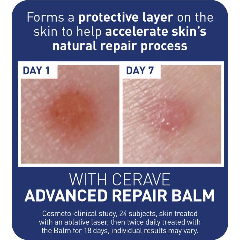 Load image into Gallery viewer, CeraVe Advanced Repair Balm 88ml
