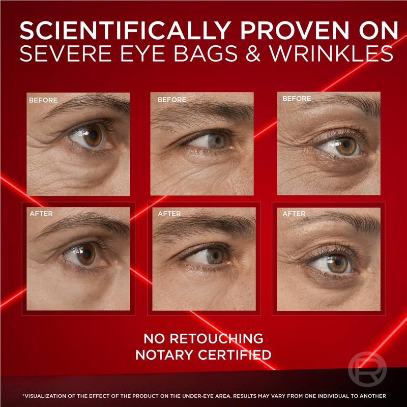 Load image into Gallery viewer, L'Oreal Laser Eye Bag Instant Eraser 15ml
