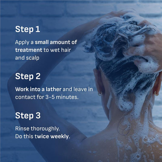 Nizoral 1% Anti-Dandruff Treatment 125ml