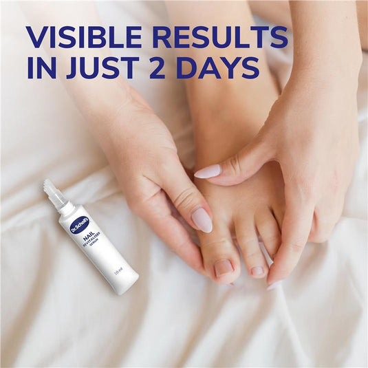 Scholl Nail Revitaliser Serum 43.2g