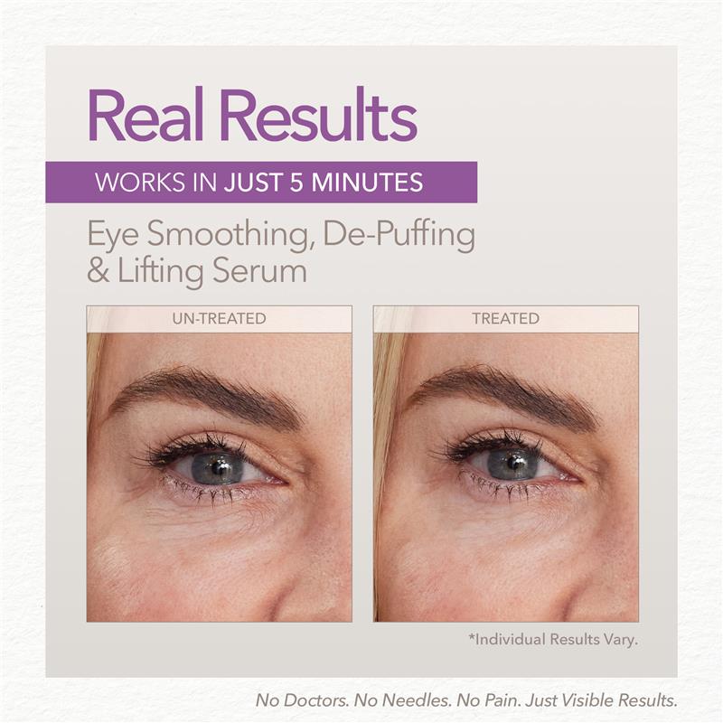 Load image into Gallery viewer, Skin Doctors Instant Eyelift 10ml
