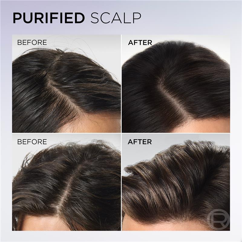 Load image into Gallery viewer, L'Oreal Elvive Hyaluron Pure Oil Erasing Scalp Serum 100ml
