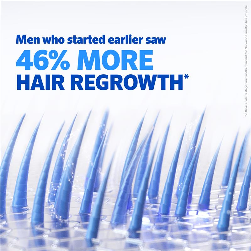 Load image into Gallery viewer, Regaine Mens 5% Minoxidil Solution Hair Regrowth Treatment 60ml
