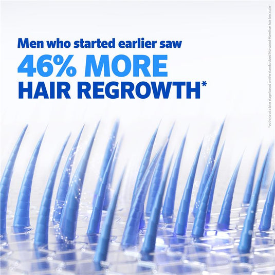 Regaine Mens 5% Minoxidil Solution Hair Regrowth Treatment 60ml
