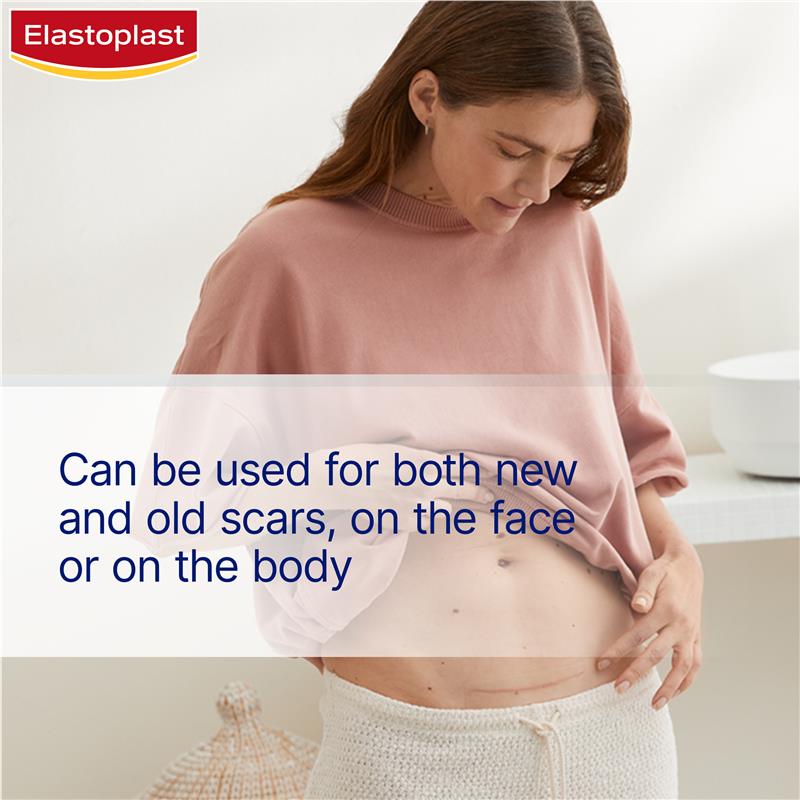Load image into Gallery viewer, Elastoplast Scar Reducer 21 Patches
