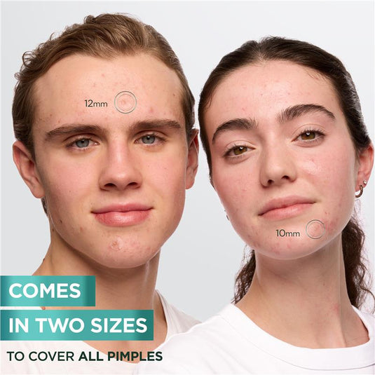 Garnier Pure Active Pimple Patch 44pk
