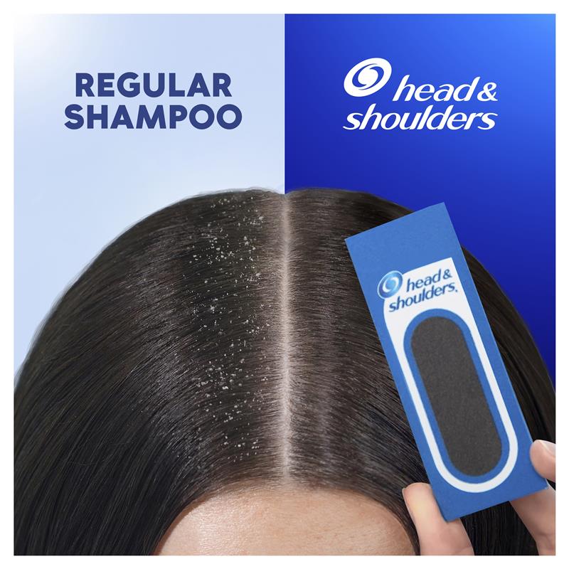 Load image into Gallery viewer, Head &amp; Shoulders Itchy Scalp Care 2in1 Shampoo + Conditioner 750ml
