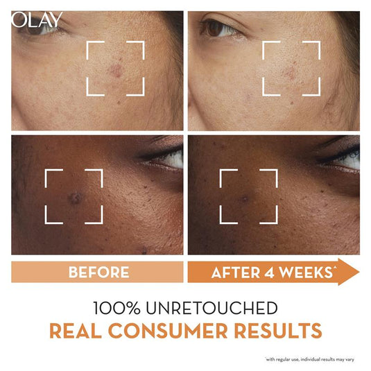 Olay Luminous Vitamin C Super Serum 30ml