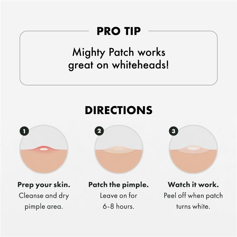 Load image into Gallery viewer, Hero Mighty Patch Original Hydrocolloid Pimple Patches 24 pack
