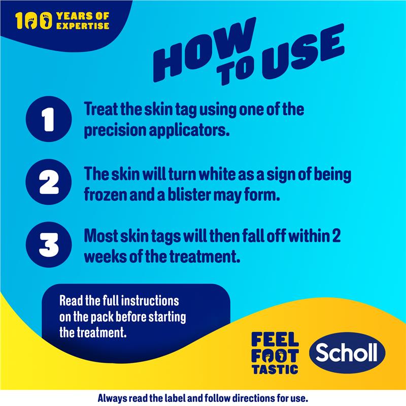 Load image into Gallery viewer, Scholl Freeze Away Skin Tag Remover
