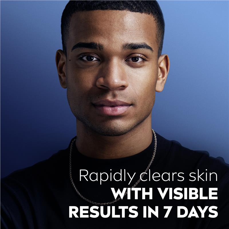 Load image into Gallery viewer, NIVEA MEN Face Wash Deep Rapid Acne Clear 150ml
