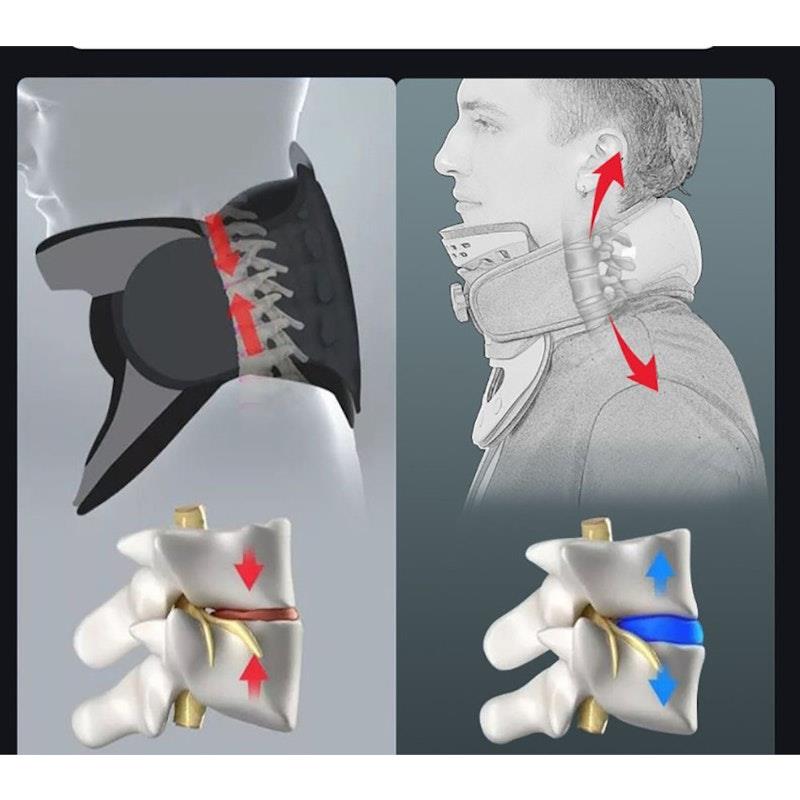 Load image into Gallery viewer, Caremax 3 in One Cervical Collar Air Bag Massage &amp; TENS &amp; Heat 1Unit
