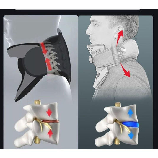 Caremax 3 in One Cervical Collar Air Bag Massage & TENS & Heat 1Unit