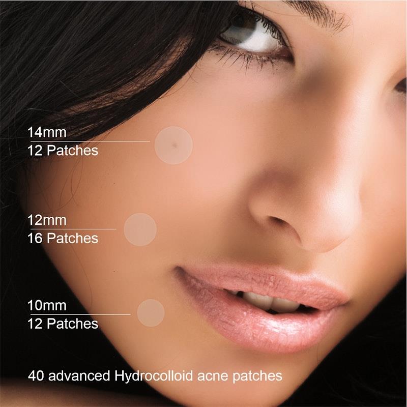 Load image into Gallery viewer, BodyAssist Advanced Hydrocolloid Acne Patches (40) - 3PACK Bundle

