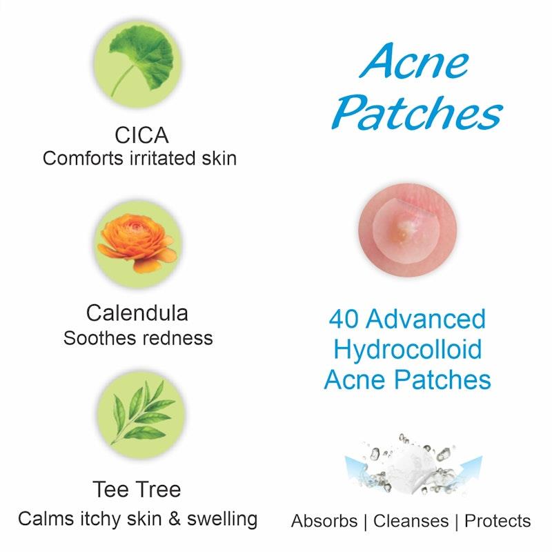 Load image into Gallery viewer, BodyAssist Advanced Hydrocolloid Acne Patches (40) - 3PACK Bundle

