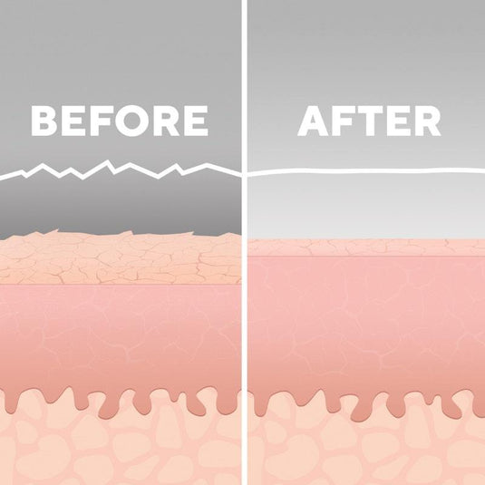 Radiance Microdermabrasion with Cooling 1Pack