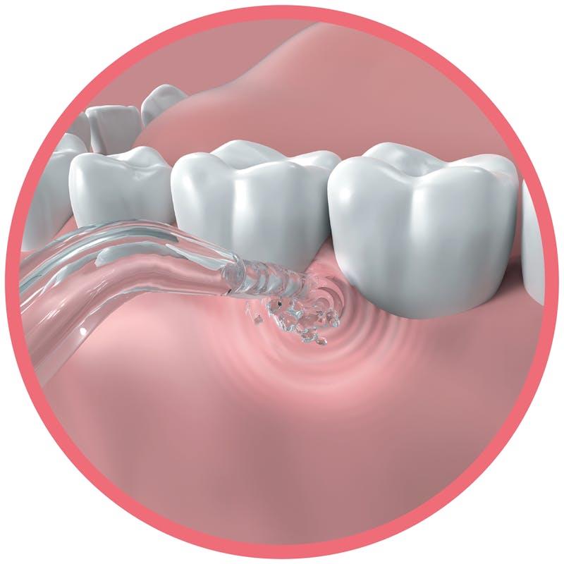 Load image into Gallery viewer, Dentagenie Water Flosser 1pc
