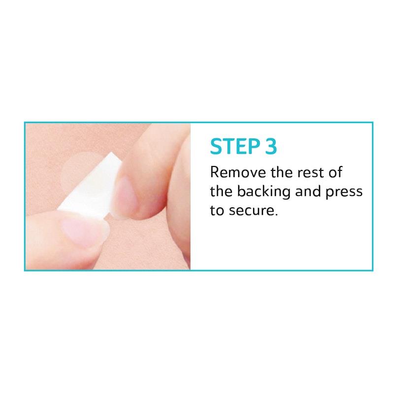 Load image into Gallery viewer, Derma Angel Acne Patch Lightening 24 Patches 3Pack
