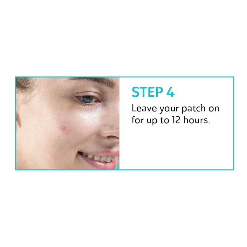 Load image into Gallery viewer, Derma Angel Acne Patch Lightening 24 Patches 3Pack
