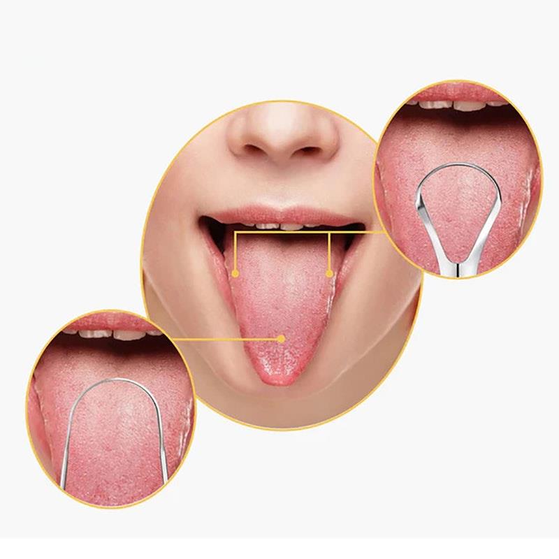 Load image into Gallery viewer, Caremax 3 Pieces Stainless Steel Tongue Scraper with Case Pack
